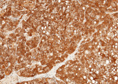 Anti-ULBP2/N2DL-2 Monoclonal Recombinant Antibody