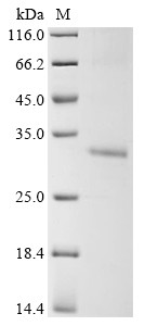 Mitochondrial glutamate carrier 2 (Slc25a18), mouse, recombinant