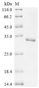 Transcriptional enhancer factor TEF-1 (TEAD1), partial, human, recombinant