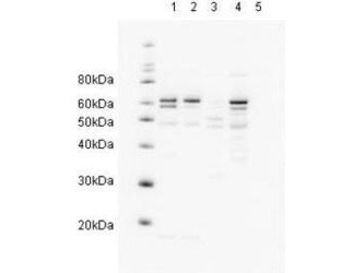 Anti-HHR23A (RAD23A)