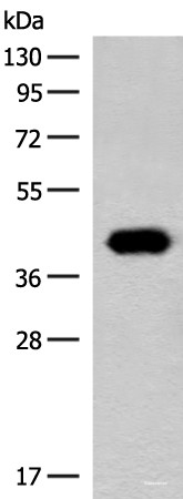 Anti-GIPC1