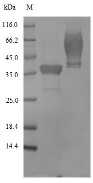 Gamma-hemolysin component B (hlgB), Staphylococcus aureus, recombinant