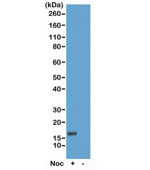 Anti-phospho-Histone H3 (Thr6), clone RM160 (recombinant antibody)