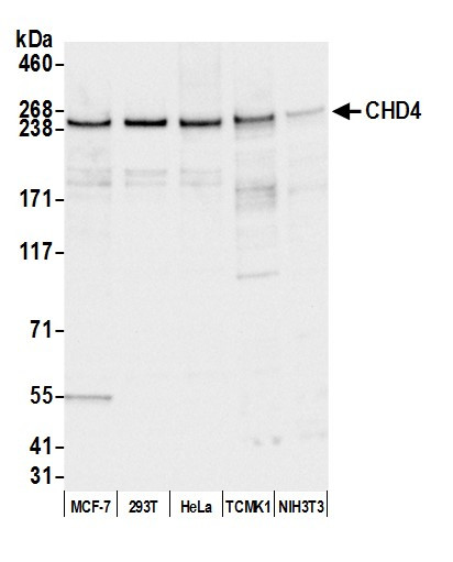 Anti-CHD4/Mi2 beta