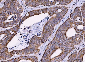 Anti-MRPS18B / 28S ribosomal protein S18b, mitochondrial