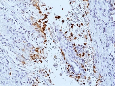 Anti-Phospho-DNA-PKcs (Ser2056) (human), Rabbit Monoclonal (RM500)