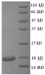 Hemoglobin subunit beta-2 (Hbb-b2), mouse, recombinant