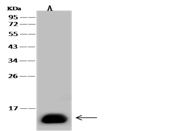 Anti-L-FABP/FABP1 Monoclonal Antibody