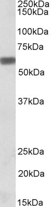 Anti-Osteopontin / SPP1, C-terminal