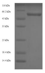 Protein disulfide-isomerase (P4HB), human, recombinant