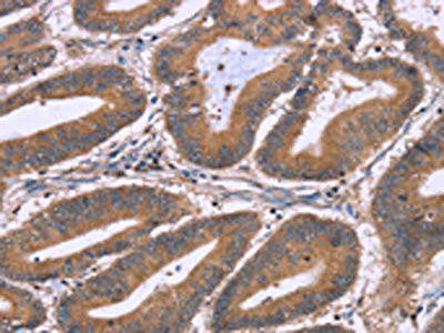 Anti-NRG1