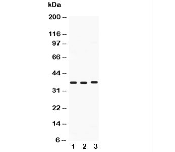 Anti-Midkine
