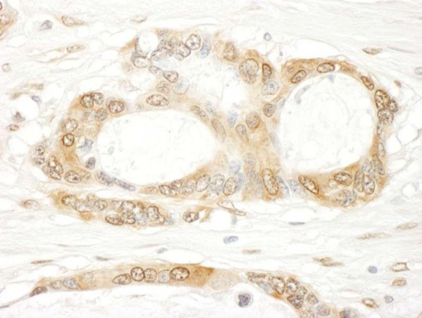 Anti-YAP1 (IHC)