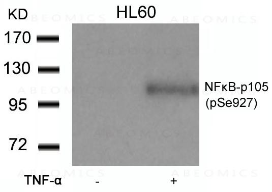 Anti-phospho-NFkB-p105/p50 (Ser927)