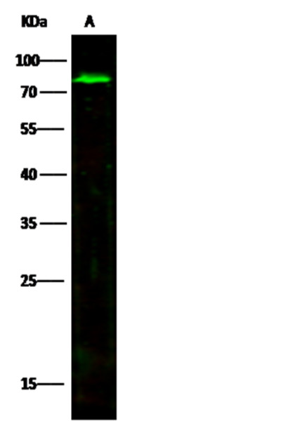 Anti-MMP-2 Monoclonal Recombinant Antibody