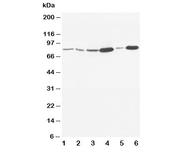 Anti-MMP9