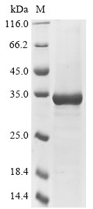 Polyprotein P1234, partial, Semliki forest virus, recombinant