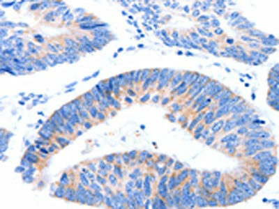 Anti-MUC3A