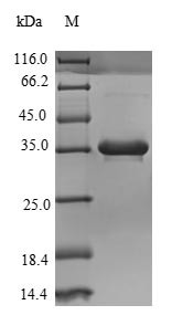 Complement C4-B (C4B), partial, human, recombinant