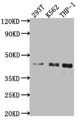 Anti-ISL1 Recombinant Monoclonal, clone 1A1