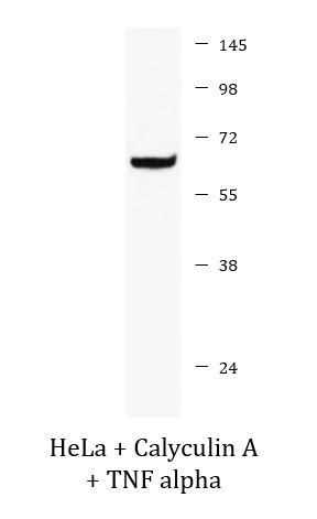 Anti-phospho-NFkB p65 (Ser529)