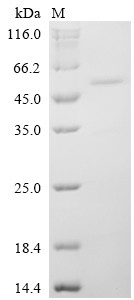 Neuronal pentraxin-1 (NPTX1), partial, human, recombinant