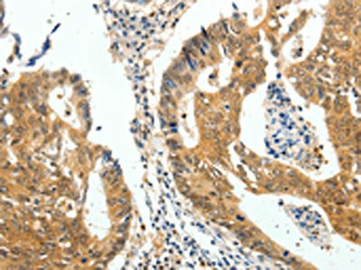 Anti-CDH23