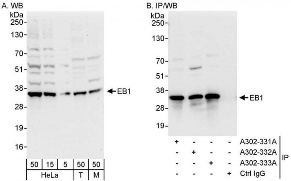 Anti-EB1