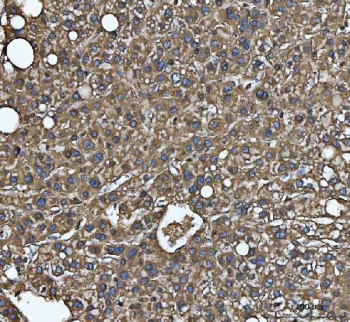 Anti-C-1-tetrahydrofolate synthase / MTHFD1