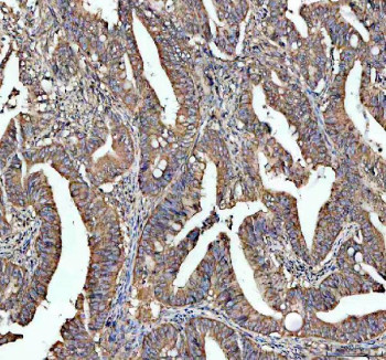 Anti-STRIP1 / Striatin-interacting protein 1