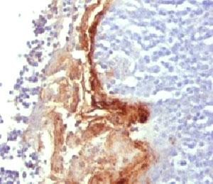 Anti-Involucrin, clone SY5
