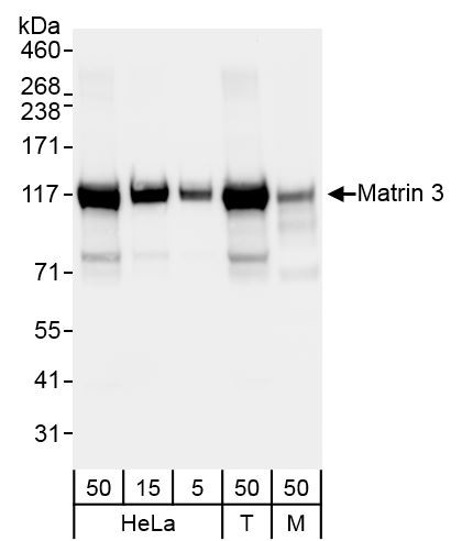 Anti-Matrin 3