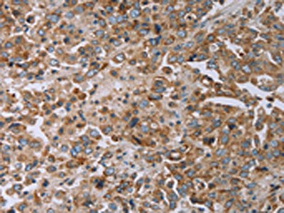 Anti-TNPO1