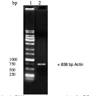 Tissue, cDNA, First Strand, Human Adult Normal, Peripheral blood leukocyte