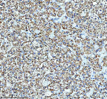 Anti-GLUD1 / Glutamate dehydrogenase 1