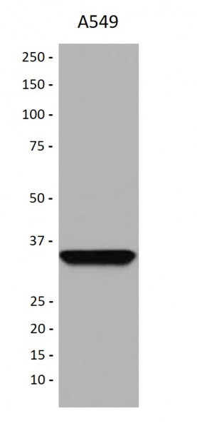 Anti-Adenosine Receptor A1