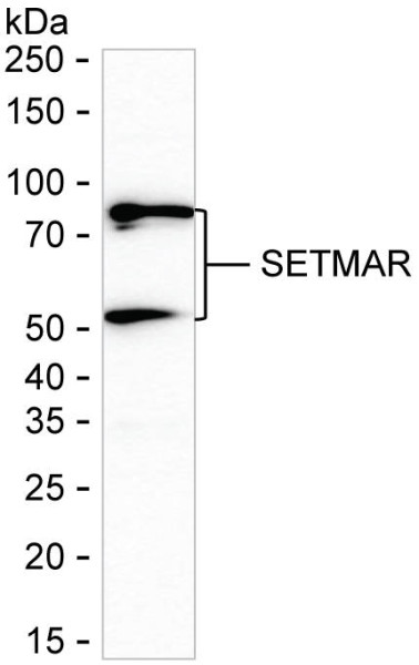 Anti-SETMAR