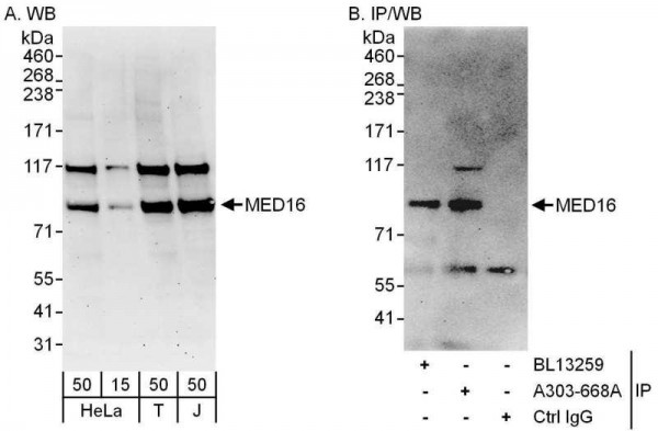 Anti-MED16