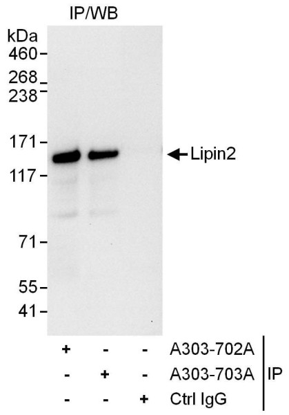 Anti-Lipin2