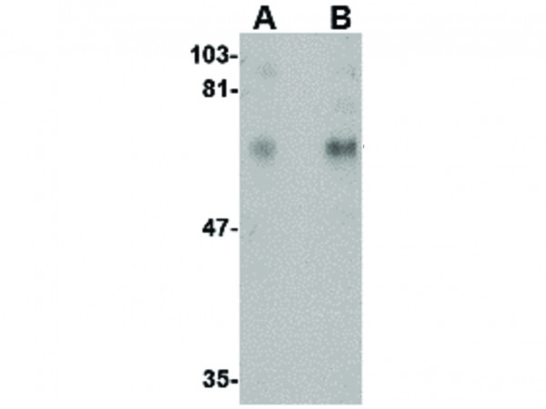 Anti-CPEB1