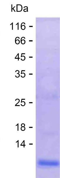 S100B (human), recombinant protein