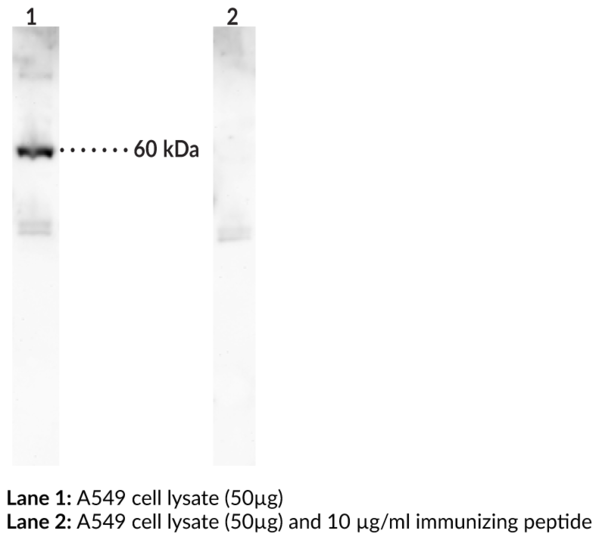 Anti-p62/SQSTM1