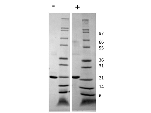 Growth Hormone