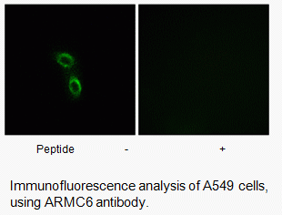 Anti-ARMC6