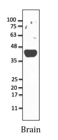 Anti-Adenosine Receptor A2a
