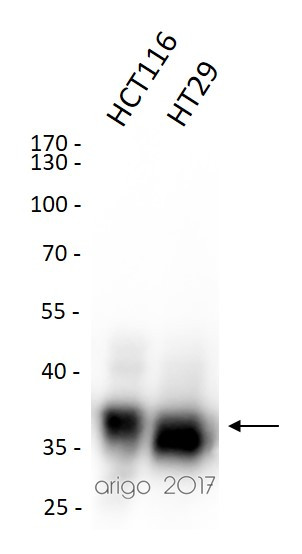 Anti-EpCAM