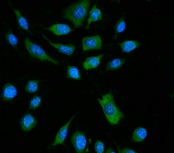 Anti-Zbp1 / Z-DNA-binding protein 1 / Dai