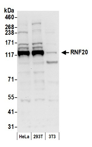 Anti-RNF20