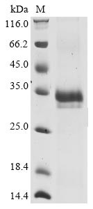 Spike glycoprotein (S), partial, human coronavirus HKU1, recombinant