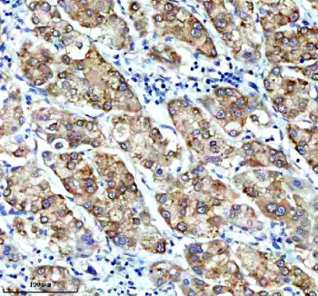 Anti-CBR1 / Carbonyl reductase 1, clone 30C98